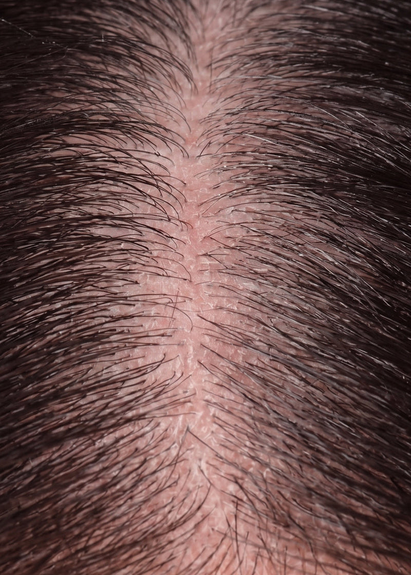 Dry & Damaged Hair