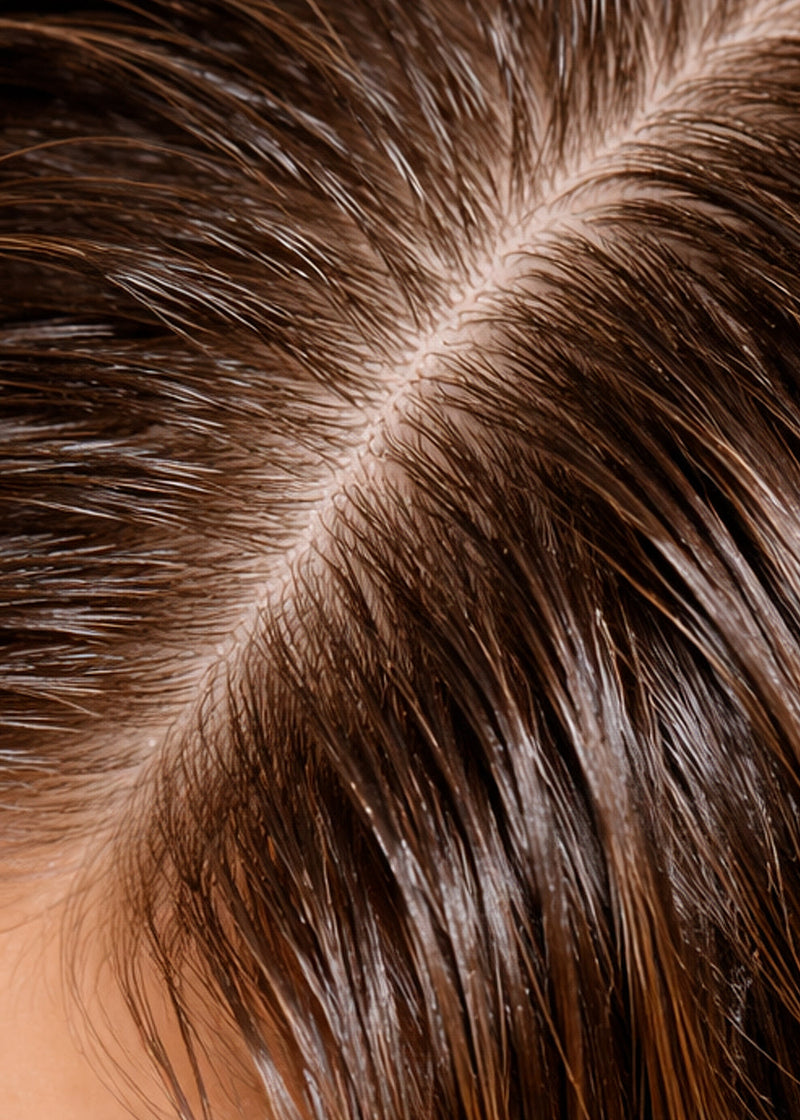 Normal Scalp