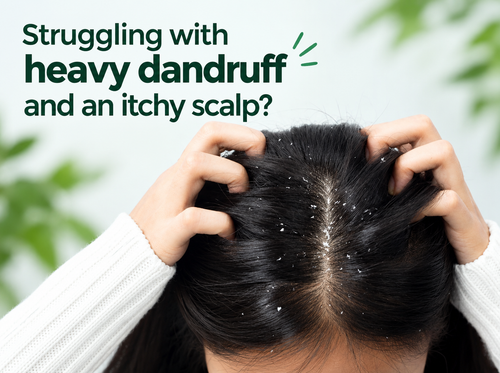 Anti-Dandruff Scalp Shampoo with Thyme Extract for Heavy Dandruff | SH-RD India