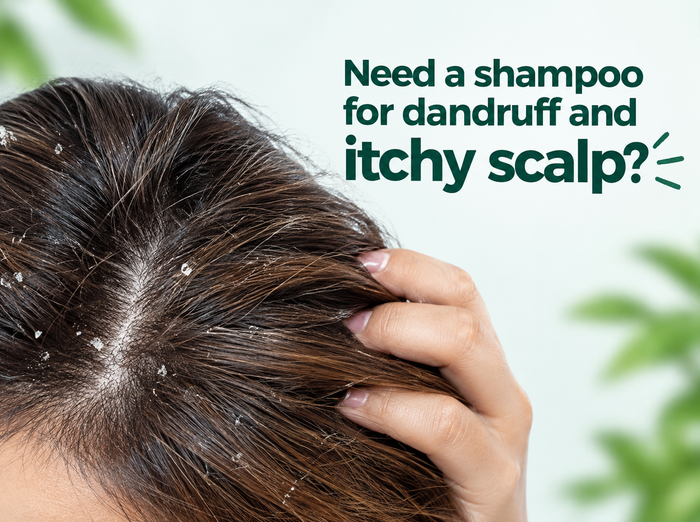 Need a Shampoo for dandruff and Itchy Scalp