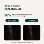 Before-and-after comparison graphic showing scalp clarity and hair growth results, with text reading 'REAL PEOPLE, REAL RESULTS' and '96% Users observed Flakes Free Scalp within 1 weeks of usage'.