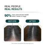 Before and after comparison of hair loss treatment with text indicating results.