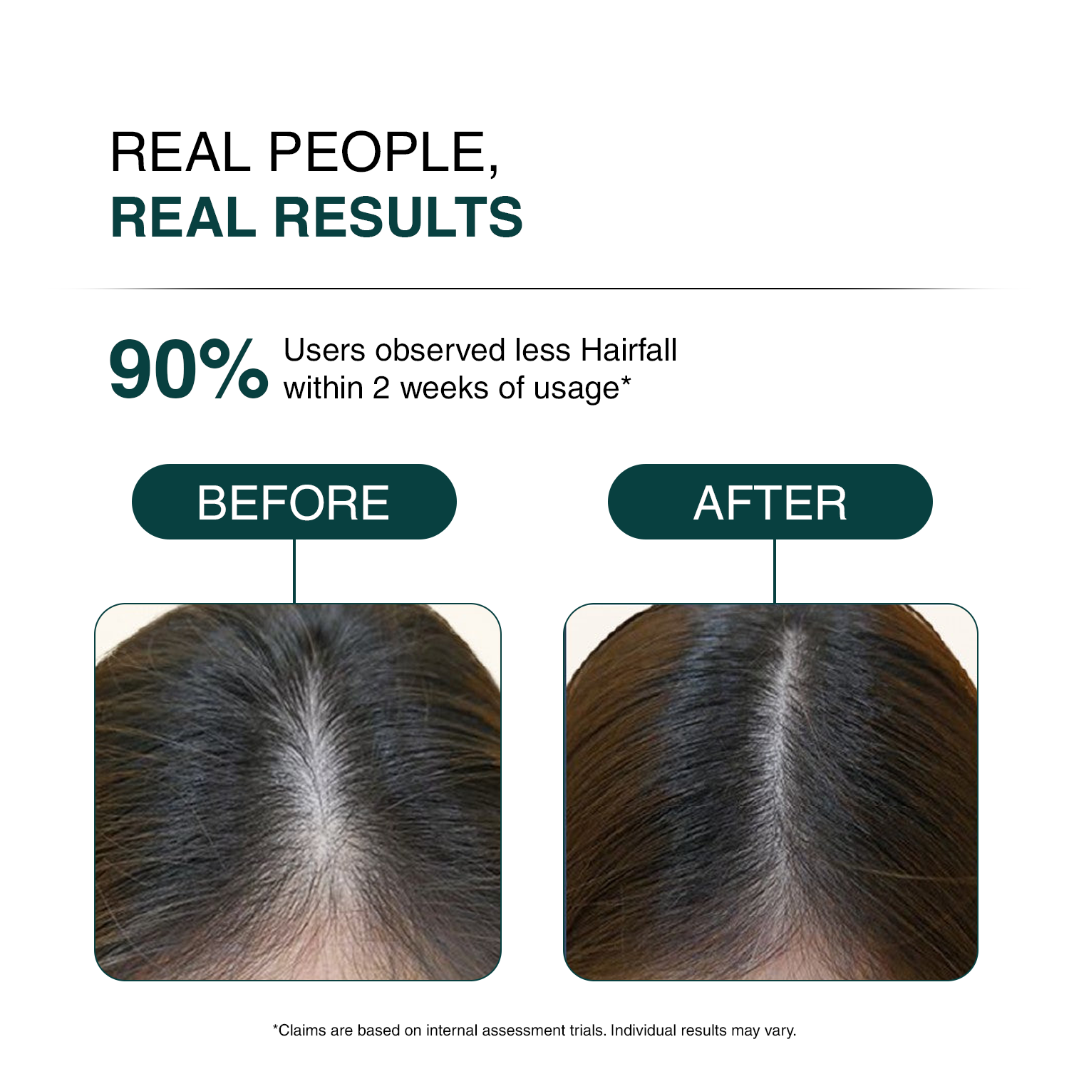 Before and after comparison of hair loss treatment with text indicating results.
