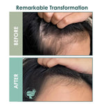 Before and after comparison of hair thickness with a hand holding the scalp.