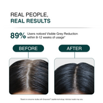 Promotional graphic for a hair parting product showing before-and-after results on human hair. The text reads 'REAL PEOPLE, REAL RESULTS' and '89% Users noticed Visible Grey Reduction within 8-12 weeks of usage*'.