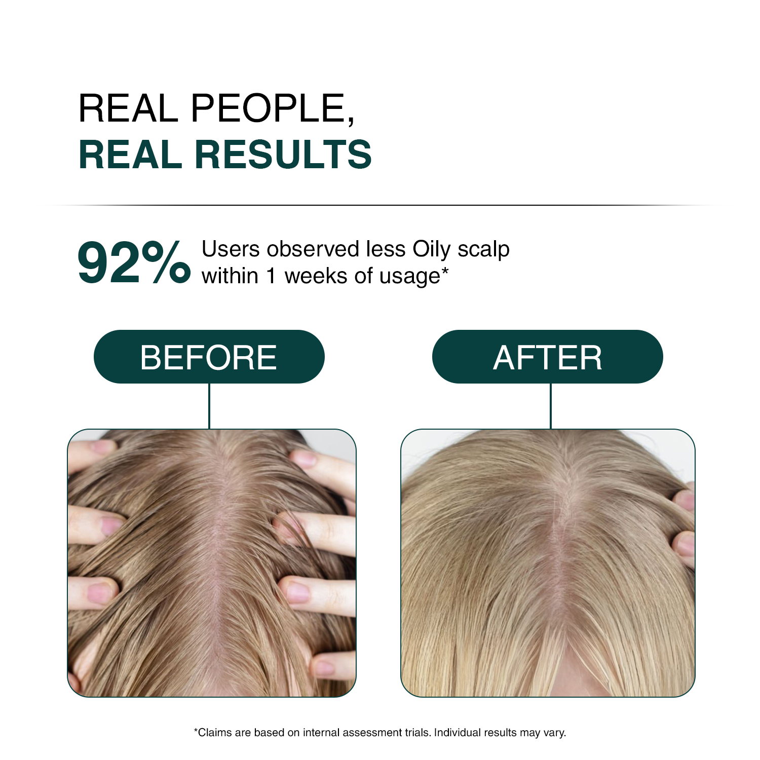 Promotional comparison graphic showing before-and-after scalp photos with text reading 'REAL PEOPLE, REAL RESULTS' and '92% Users observed less Oily scalp within 1 weeks of usage'.