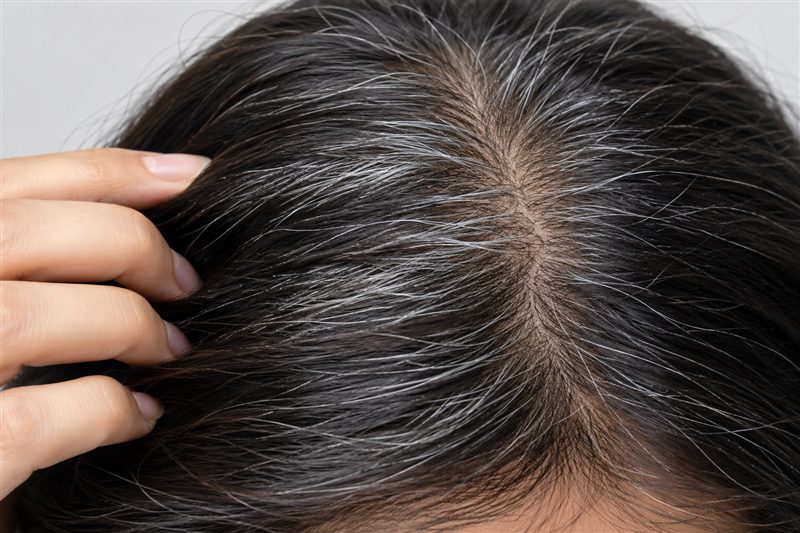 Grey hair